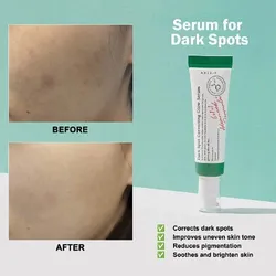 Dark Spot Correcting Glow Serum AXIS-Y 5 ml 
