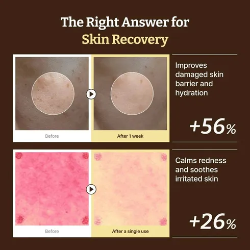 Dr. Reju-All Advanced PDRN Rejuvenating Cream (20ml)